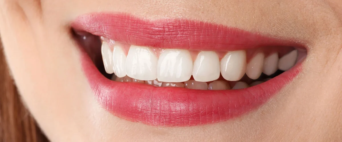 dental-after
