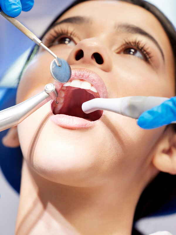 dental-img15