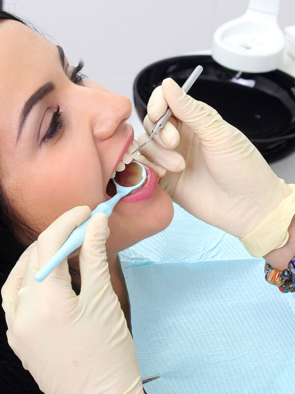 dental-img19