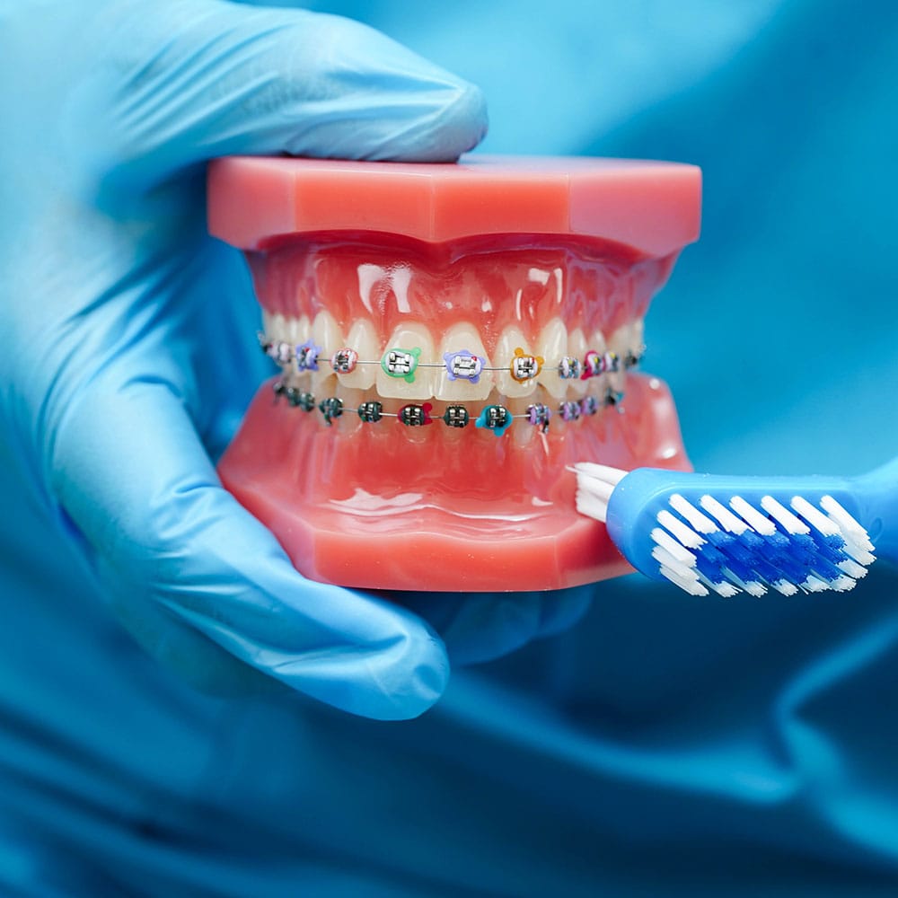 dental-img20