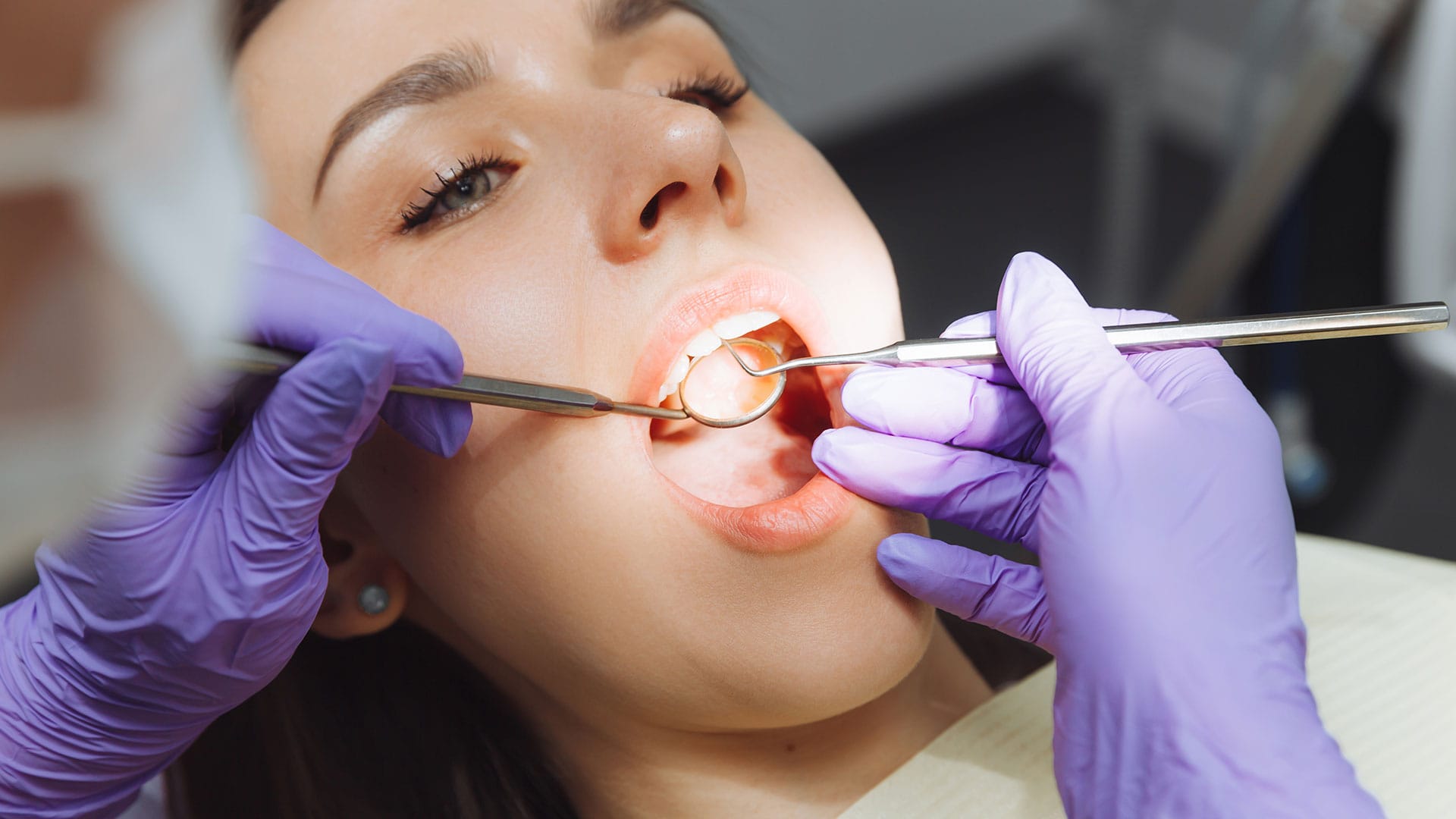 dental-img4